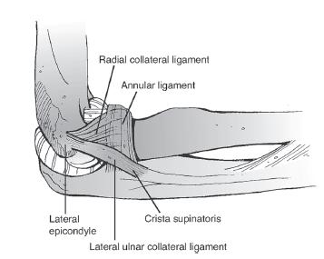 Lateral Condyle Fractures | Obgyn Key