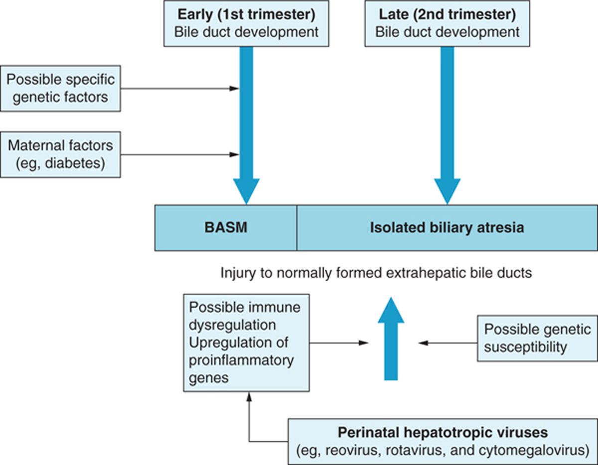 Biliary Tract Anomalies Obgyn Key