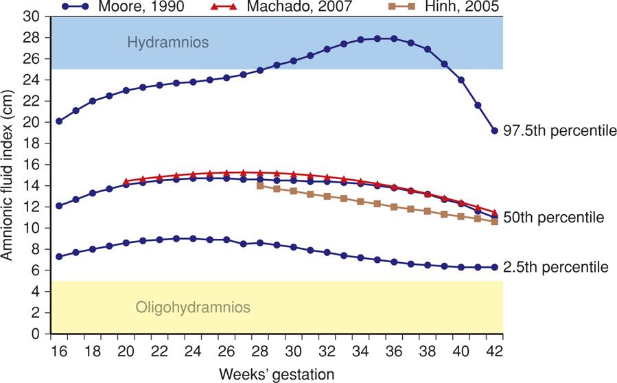 Normal Amniotic Fluid Index Chart 018