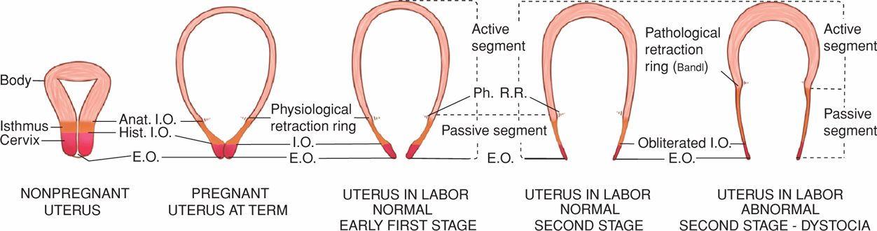 Konsulat Verkaufsplan Zweifel Bandl Ring Uterus Gehirn Pfund Minimieren