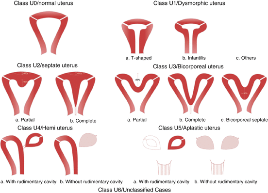 charge syndrome genital abnormalities