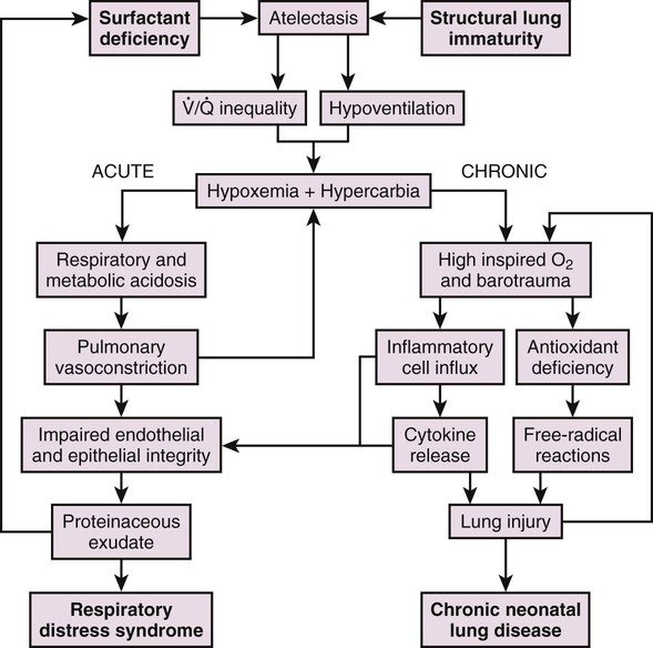 Respiratory Distress Syndrome In The Neonate | Obgyn Key