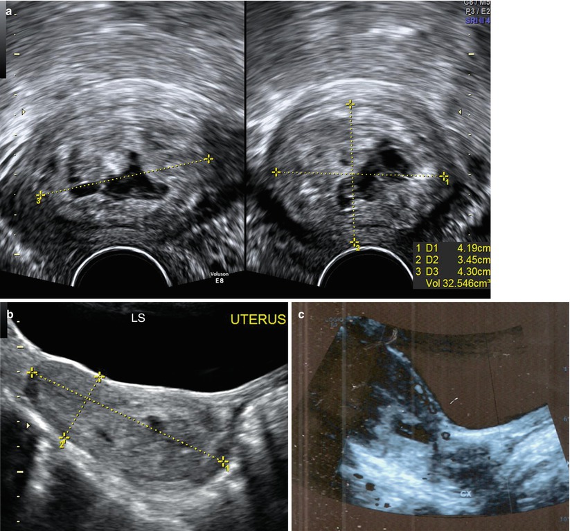 Ultrasound Evaluation Of Pregnancy-Related Conditions | Obgyn Key