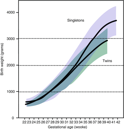 Twin Pregnancies Obgyn Key