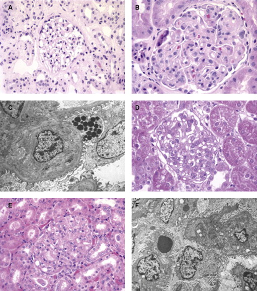 Angiogenesis And Preeclampsia | Obgyn Key