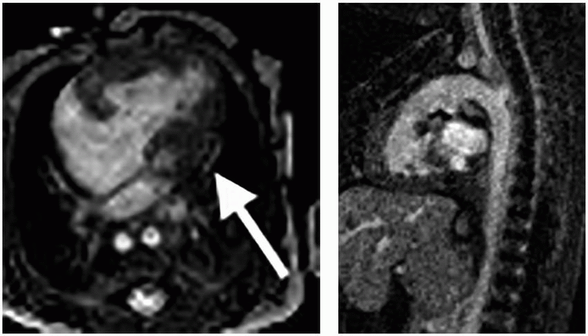 Pediatric Cardiac Radiology | Obgyn Key