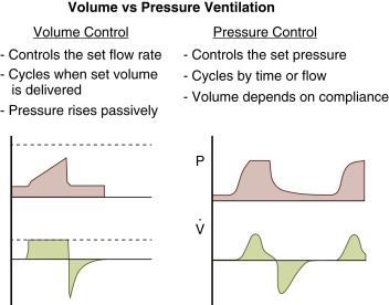 Tidal Volume-Targeted Ventilation | Obgyn Key