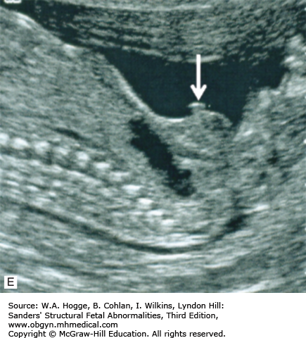 THE GENITOURINARY SYSTEM | Obgyn Key