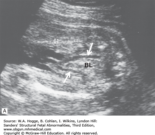 THE GENITOURINARY SYSTEM | Obgyn Key