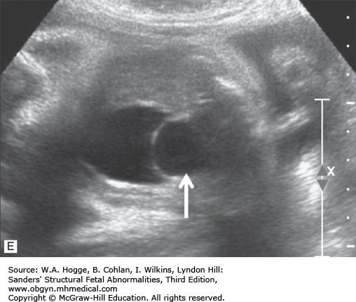 THE GENITOURINARY SYSTEM | Obgyn Key