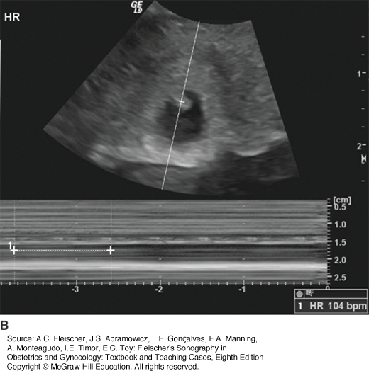 Guided Procedures Using Transvaginal, Transabdominal, And Transrectal ...