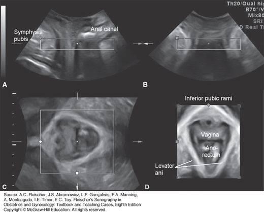 Pelvic Floor Ultrasound | Obgyn Key