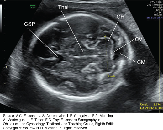 Fetal Biometry: Relevance In Obstetrical Practice, 52% OFF