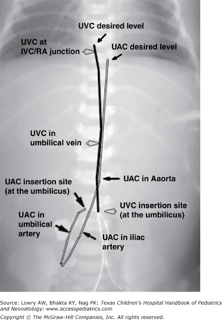 Procedures | Obgyn Key