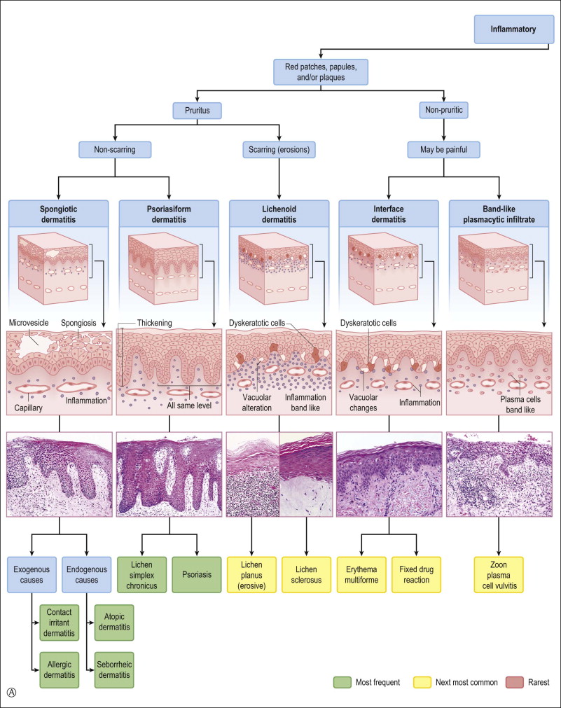 Vulvar Dermatoses And Infections | Obgyn Key