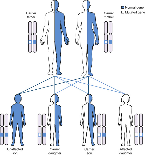 Expanded Carrier Screening | Obgyn Key