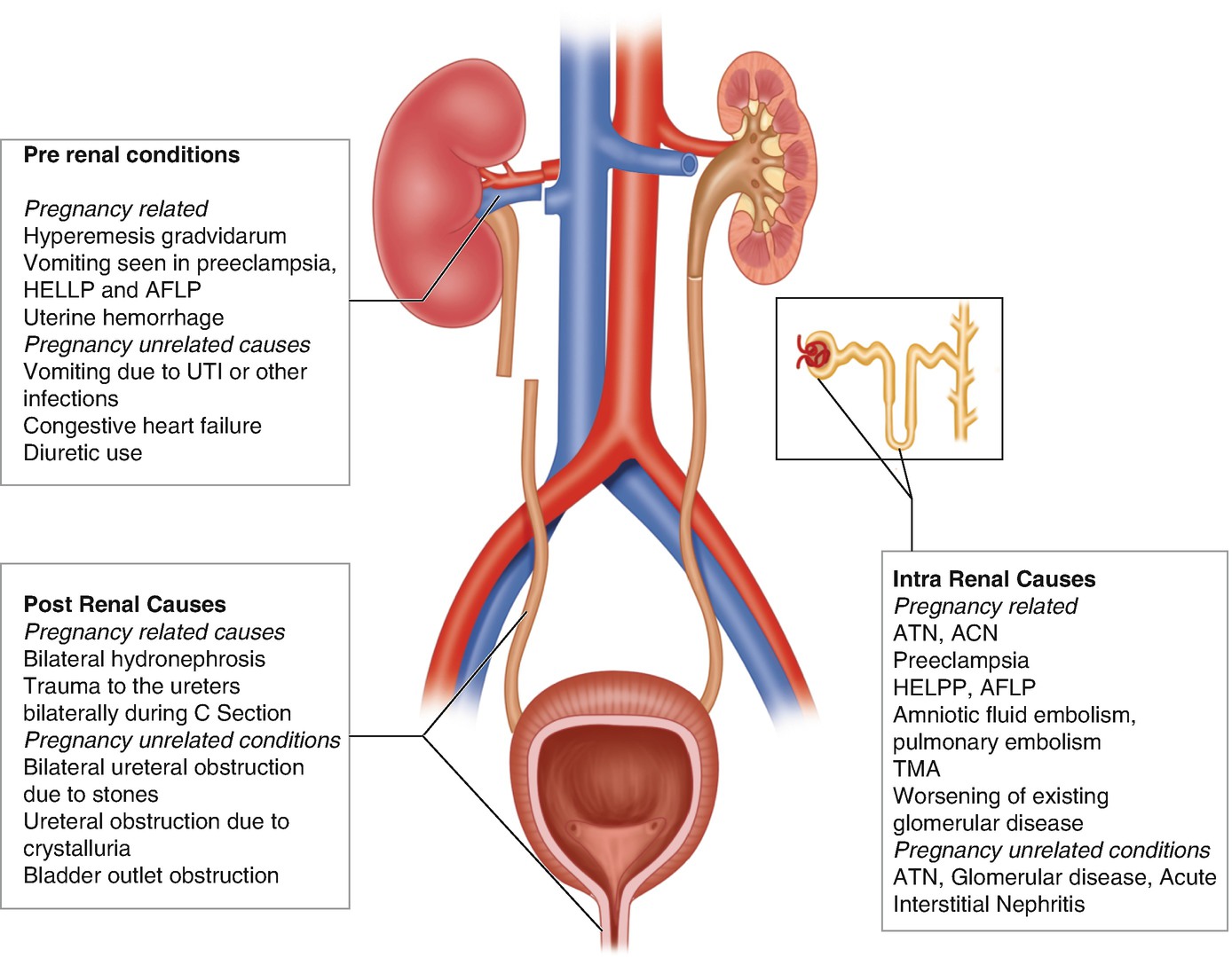 kidney-injury-during-pregnancy-obgyn-key