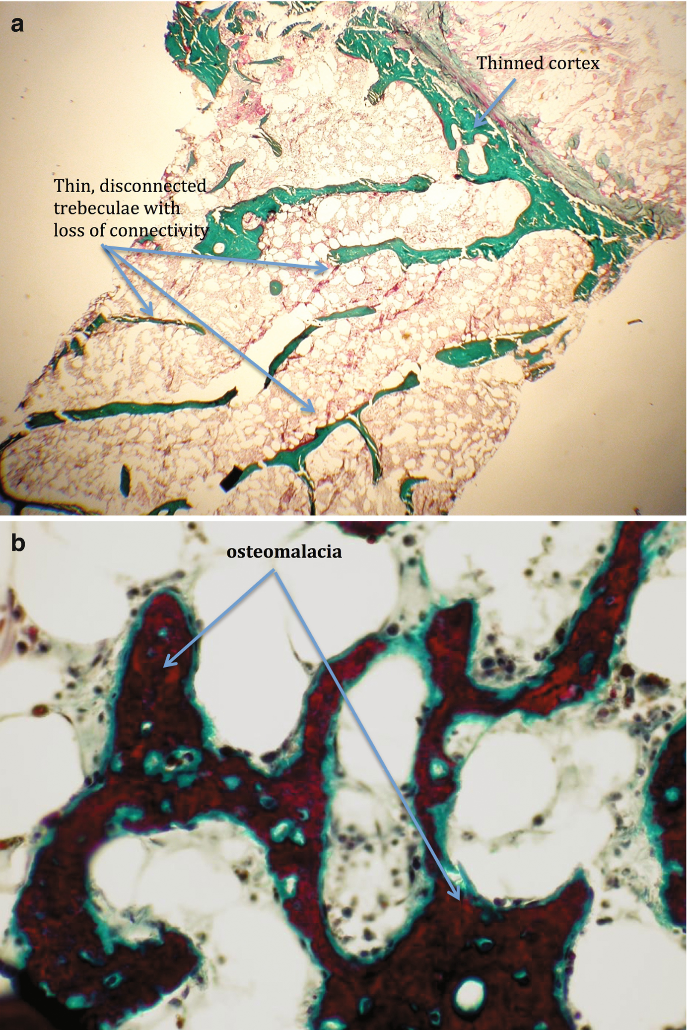 ../images/393995_1_En_18_Chapter/393995_1_En_18_Fig5_HTML.png