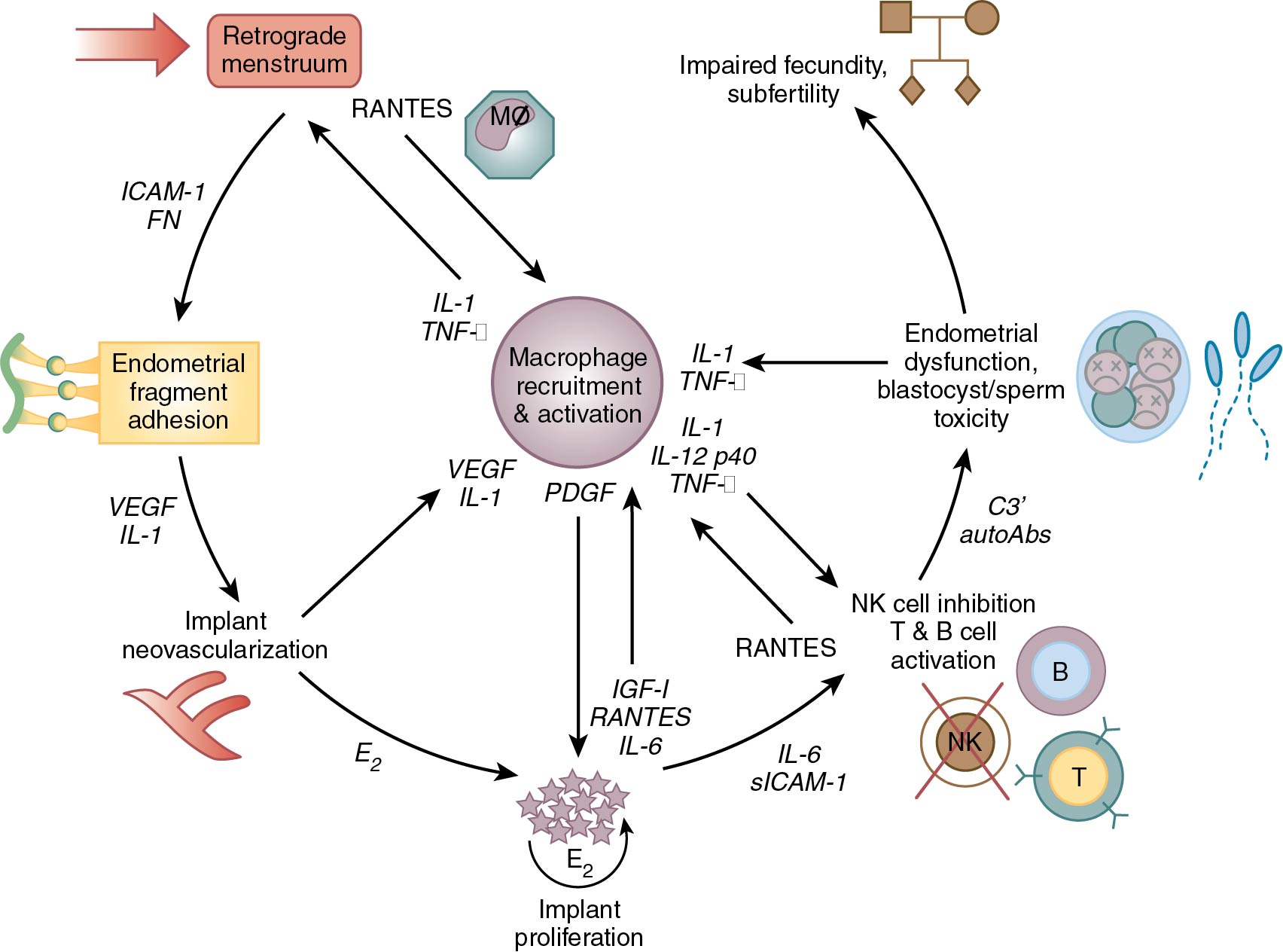 Endometriosis: Etiology, Pathology, Diagnosis, Management | Obgyn Key